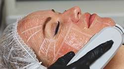 Woman receiving a professional skin care treatment with a mesh mask applied to her face in a Burnaby spa